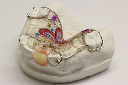 Ортодонтическая пластинка